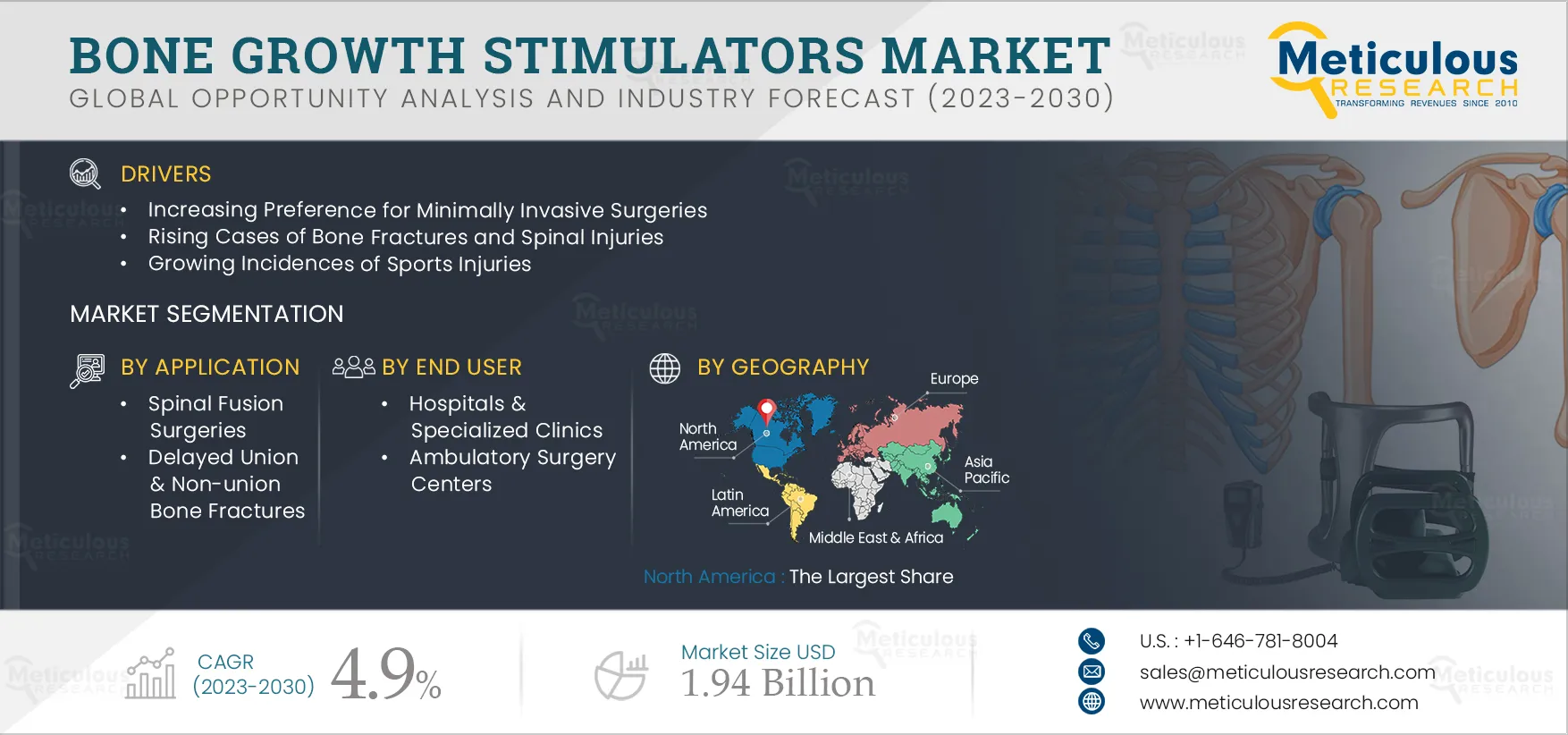 Bone Growth Stimulators Market