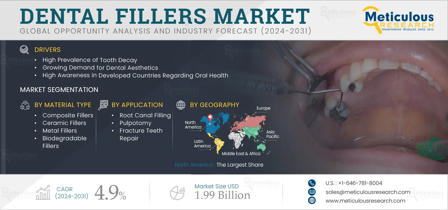 Dental Fillers Market 