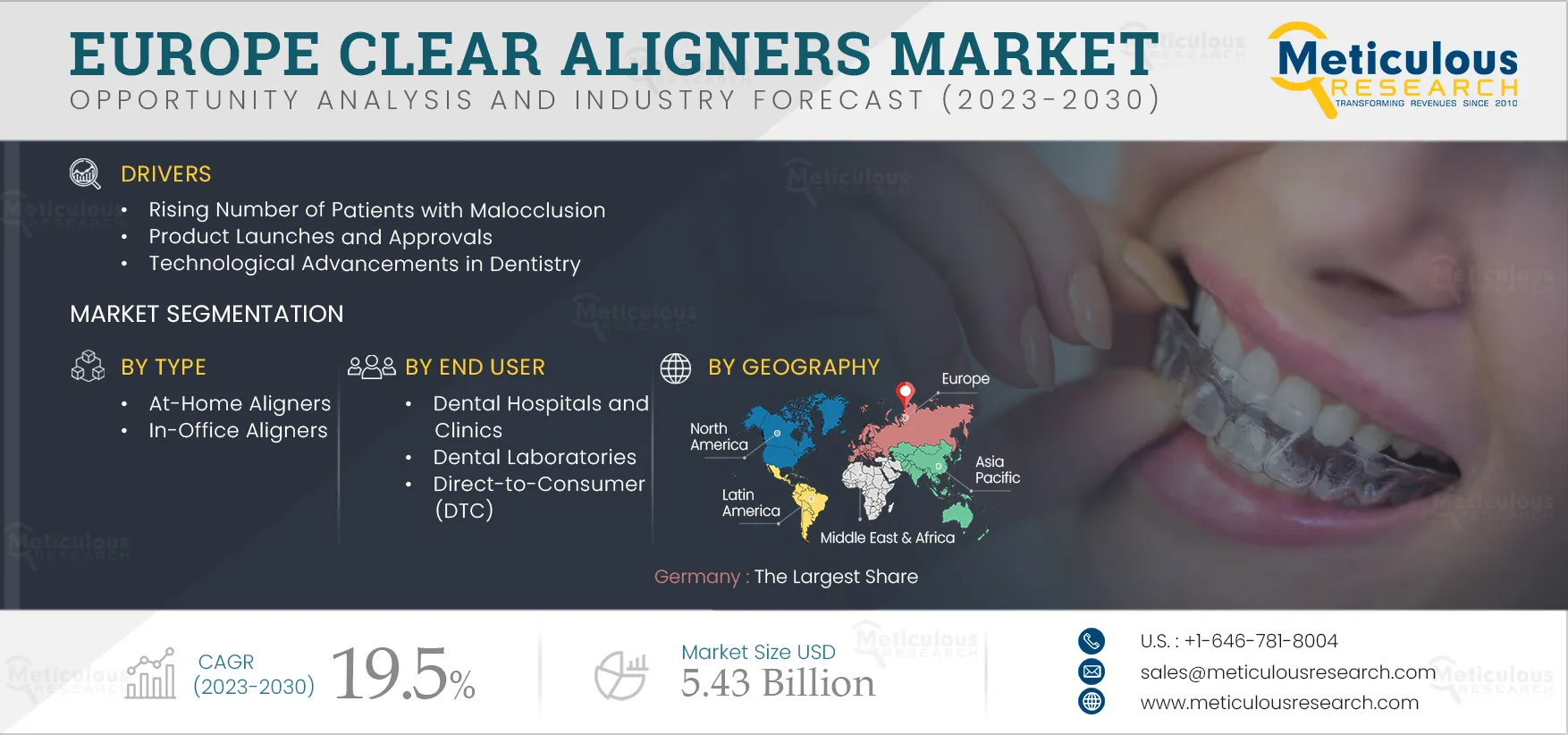 Europe Clear Aligners Market