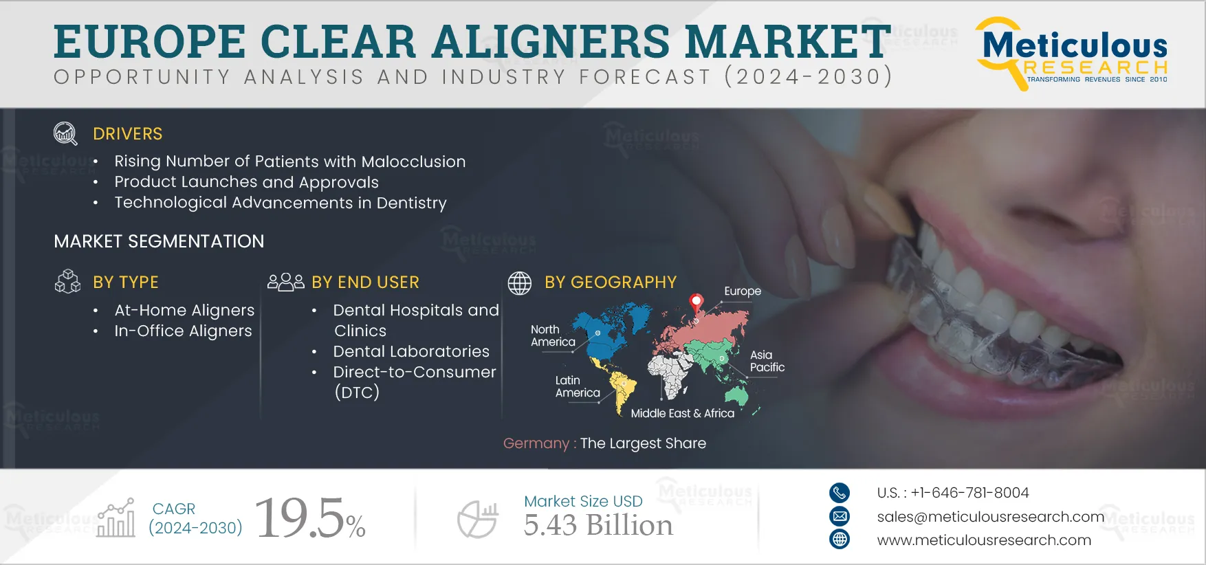 Europe Clear Aligners Market Europe Clear Aligners Market