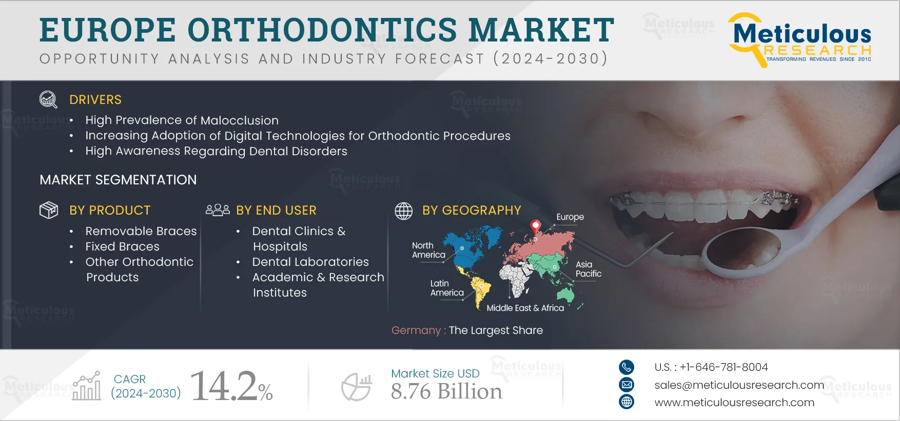 Europe Orthodontics Market