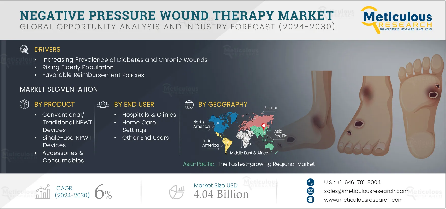 Negative Pressure Wound Therapy (NPWT) Market