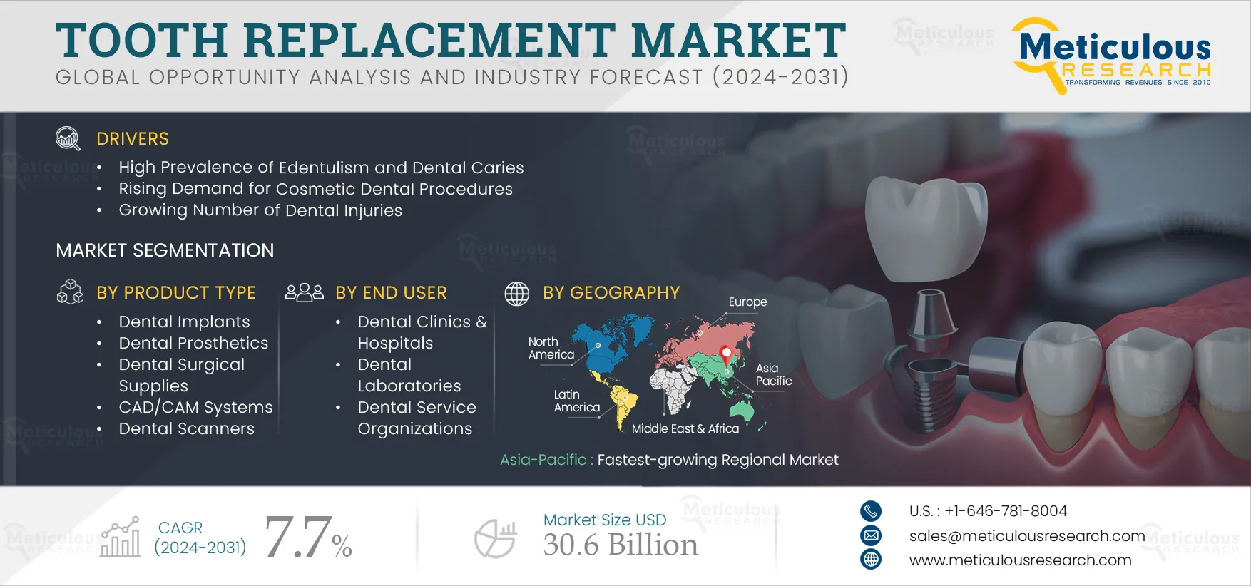 Tooth Replacement Market